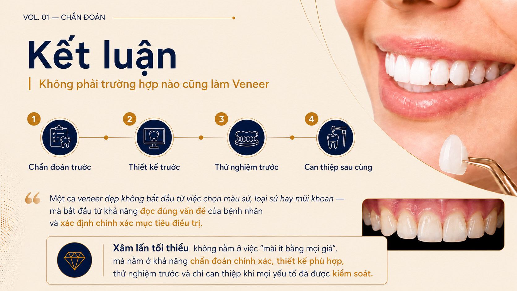 Checklist trước khi chỉ định Veneer