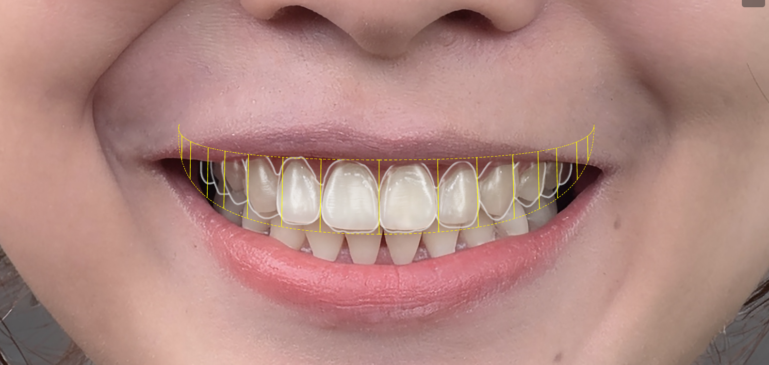 Phân tích DSD trên ảnh