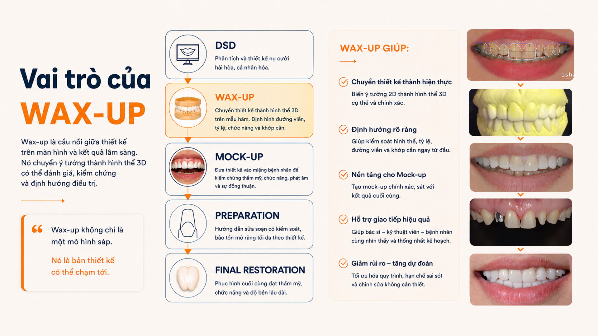 Vai trò của Wax-up