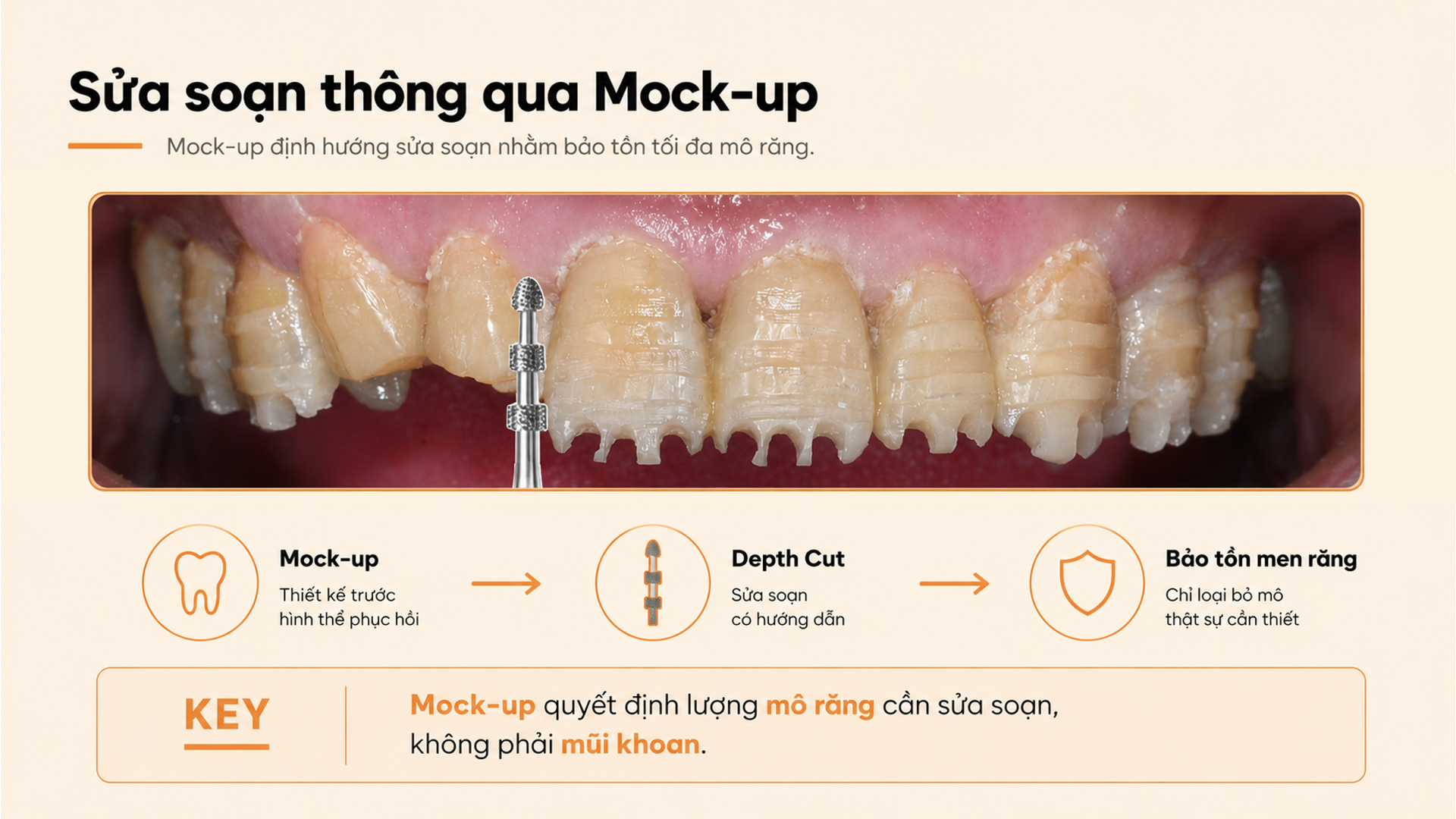 Sửa soạn thông qua Mock-up